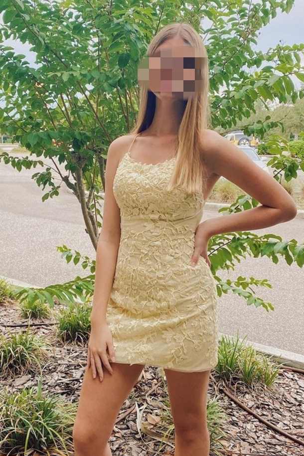 Tight Yellow Lace Short Homecoming Dress